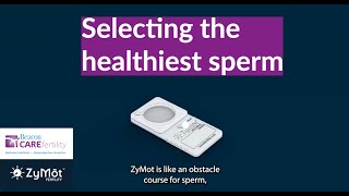 Sperm Selection Technology at Beacon CARE Fertility ZyMot [upl. by Lindholm]