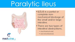 Paralytic Ileus  causes pathophysiology clinical features diagnosis and treatment [upl. by Ahsai431]