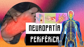 Neuropatía periférica [upl. by Horacio]