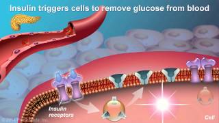 Understanding Type 2 Diabetes [upl. by Einreb]