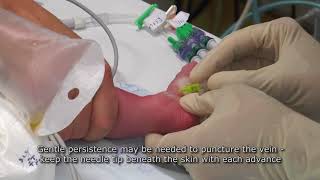 Paediatric Anaesthetics Chapter 7  Long saphenous IV neonate 1 [upl. by Anivol]