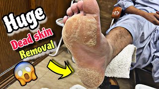 How to do a pedicure professionally  huge callus removal on foot sole  dead skin remove [upl. by Myer]