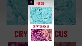 Morphology of some pathogenic fungi pathologyacademy mbbs draditikumar labtechnician [upl. by Pinkham]