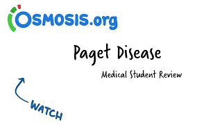 Paget Disease Osmosis Study Video [upl. by Charlie]