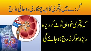 Gurdy Main Pathri Ka Rohani Ilaj  Gurday Ki Pathri Se Nijat Ka Taweez  Taweez For Kidney Pain [upl. by Yot]