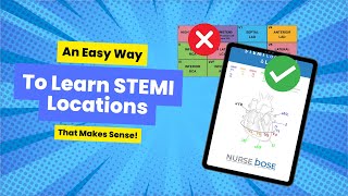 An Easy Way to Memorize STEMI Locations and Leads [upl. by Hedges]