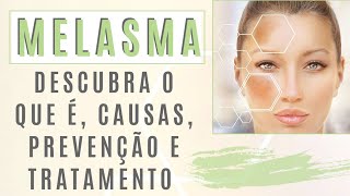 Melasma  Descubra o que é causas prevenção e tratamentos [upl. by Gnen]