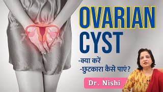 😱Ovarian Cyst क्या होता है क्यों होता है❇️Ovarian Cyst से कैसे छुटकारा पाएं Ovarian Cyst in Hindi [upl. by Deloria]