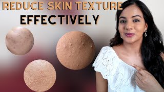 Improve Skin Texture  Get Smooth amp Even Skin Tone [upl. by Cristionna]