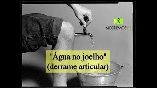 quotÁgua no joelhoquot derrame articular [upl. by Elleyoj]