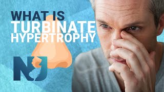 What Is Turbinate Hypertrophy  We Nose Noses [upl. by Noorah416]