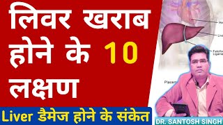 Liver Kharab Hone Ke Lakshan  Liver Damage Symptoms and Sign Explained [upl. by Acinoed]