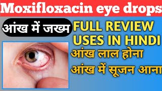 Moxifloxacin Eye Drops Hindi  Moxifloxacin And Dexamethasone Eye Drops [upl. by Ot932]