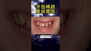 牙齿稀疏爱说是非 传统文化 面相physiognomy [upl. by Oakie657]