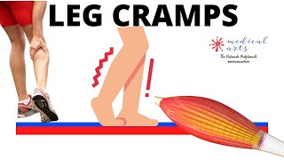 Leg Cramps Muscle Spasms Definition Causes Treatment Prevention [upl. by Livesay]