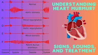 Understanding Heart Murmurs What You Need to Know [upl. by Enitsyrk]