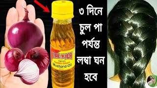 ৩ দিন এটা লাগাও চুল পড়া বন্ধ হবে চুল ঘন লম্বা কালো হবে নতুন চুল গজাবেhair growth remedies [upl. by Salman]