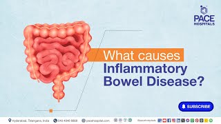 IBD Main causes  What causes Inflammatory Bowel Disease  ibd [upl. by Ttocs]