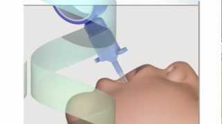 Neonatal Endotracheal Intubation [upl. by Solracsiul]