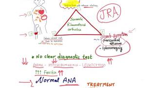 Juvenile Rheumatoid Arthritis mnemonic [upl. by Kapeed]