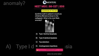 NEET MDS  INICET MDS  PSC  BDS  Most Important Questions neetmds2025 mdsprep [upl. by Hufnagel]