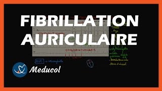 La Fibrillation Auriculaire Définition et Symptômes [upl. by Anthea14]