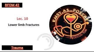 Lecture 10  Lower Limb Fractures  Trauma 42 [upl. by Rayham]