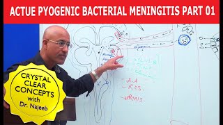 Acute Pyogenic Bacterial Meningitis Part 1 🩺 [upl. by Feer]