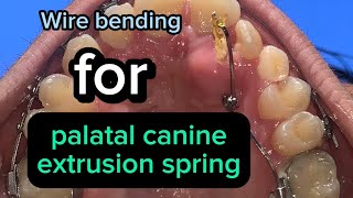 شرح توضيحي wire bending for palatal canine extrusion spring [upl. by Faunie]