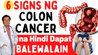 6 Signs ng Colon Cancer na Hindi Dapat Balewalain  Payo ni Doc Willie Ong [upl. by Dniren486]