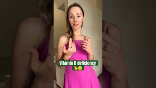 Vitamin D deficiency health nutrition [upl. by Naujej61]