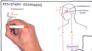 Gynaecology  Infertility in Women causes and pathophysiology [upl. by Pejsach]