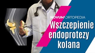 Obustronna ALLOPLASTYKA KOLAN  zabieg WSZCZEPIENIA ENDOPROTEZY stawu kolanowego  Novum Ortopedia [upl. by Stralka87]