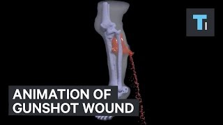 Animation of gunshot wound [upl. by Lamrert]