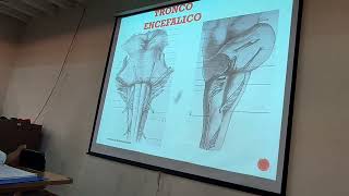 170624 TRONCO ENCEFÁLICOMÉDULA OBLONGADA PROTUBERANCIACUARTO VENTRICULO TECHO Y SUELO [upl. by Darrick]