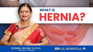 Reasons for Hernia  Easy Solutions  Dr Kamala Selvaraj  GG Hospital  hernia gg gghospital [upl. by Kramal743]