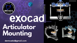 exocad digital model mounting with articulator [upl. by Eikram776]