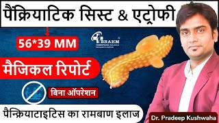 Atrophy Pancreatitis Treatment  Pseudocyst Pancreatitis treatment hindi  Best Pancreas treatment [upl. by Vladamar]