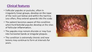 Lecture200 Acquired disorders of Pilosebaceous units Rooks chapter 93 [upl. by Alleen]