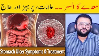 Stomach Ulcer Symptoms amp Treatment  Stomach Ulcer Ka Ilaj  Maidey Ka Ulcer  Dr Raja Omer Fiaz [upl. by Hastings]