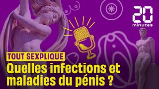 Quelles infections et maladies du pénis   Podcast [upl. by Bar]