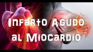 Infarto agudo al miocardio [upl. by Leunamne]