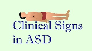 ASD clinical findings illustration [upl. by Blau827]