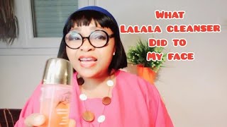 REVIEW ON LALALA CLEANSERSERUM  WHAT YOU SHOULD KNOW ABOUT LALALA CLEANSER [upl. by Lawson]