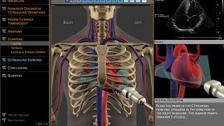 Basics of ultrasound machine [upl. by Amelia]