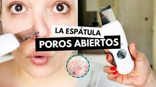 Pruebo la ESPÁTULA ULTRASÓNICA contra POROS ABIERTOS y sebo facial  Pretty and Olé [upl. by Wooldridge]