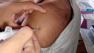 im injection kaise lagate hai How to give intramuscular injection Intramuscular injection in arm [upl. by Guria]