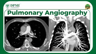 Pulmonary Angiography Indications Techniques amp Results What Is Pulmonary Angiography Used For [upl. by Clive]