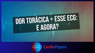 Dor torácica  esse ECG e agora [upl. by Nylrahs879]