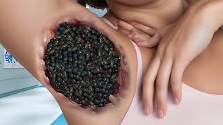 ASMR Dongla Armpit Treatment  ASMR Remove Gandul Maggots from Armpit  ASMR mashi [upl. by Nelson353]